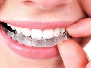 The Role of Invisalign in Boosting Your Oral Health Regimen